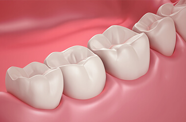 Port Jefferson Smiles-Karen Halpern DMD, MS-dental sealant