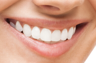 Port Jefferson Smiles-Karen Halpern DMD, MS-gummy smile cosmetic treatment